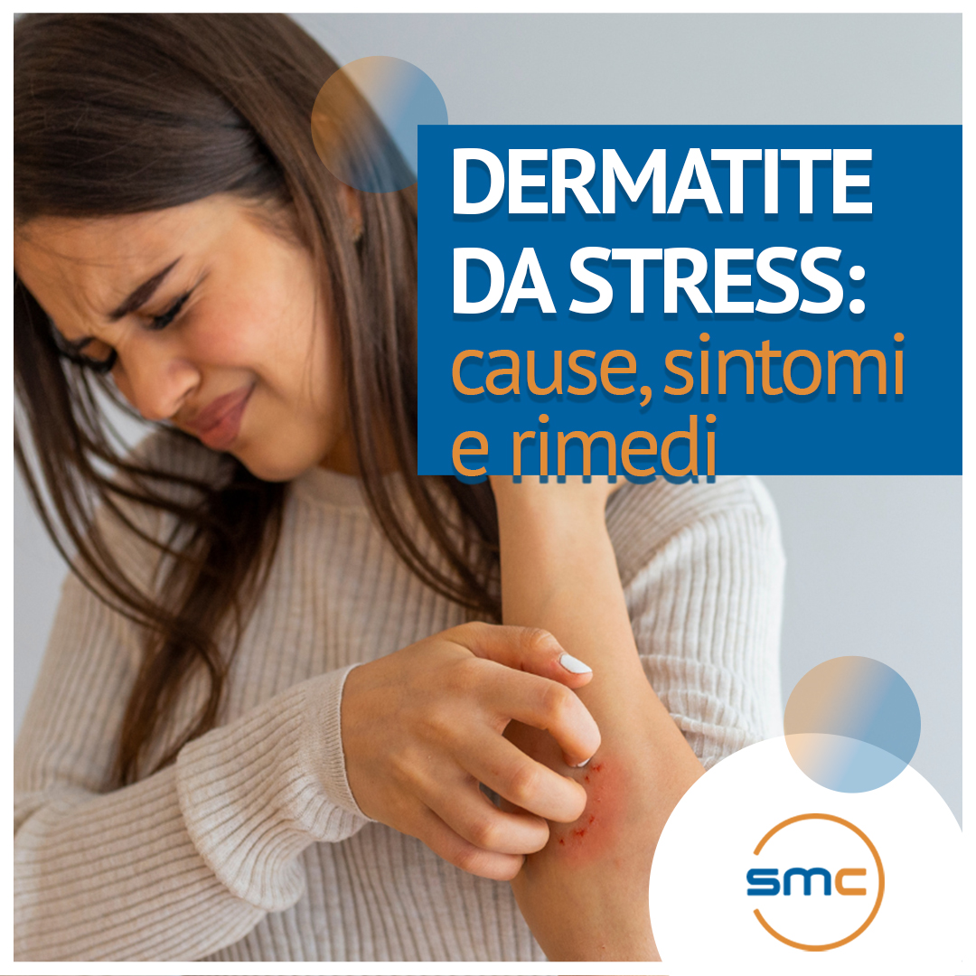 Dermatite Da Stress Cause Sintomi E Rimedi SMC